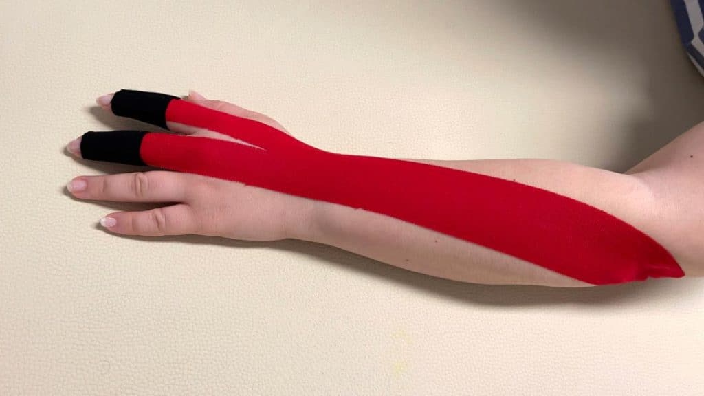 ΘΕΡΑΠΕΙΑ KINESIOTAPING